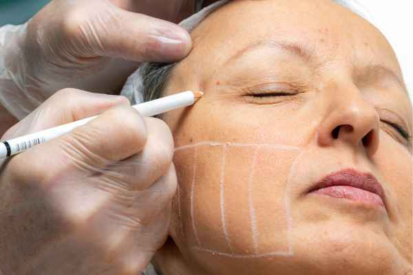 CryoPen: 5 Skin Concerns It May Be Used to Treat 4 What should you ask before having CryoPen treatment Bristol?