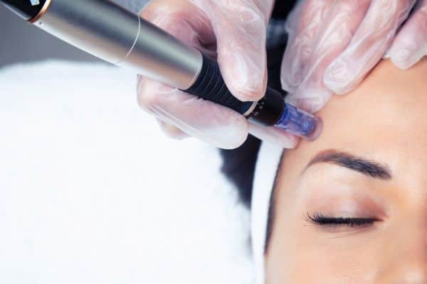 Explaining Total Skin Tightening Treatment and What to Expect 2 What Skin Concerns Can Total Skin Tightening Treatment Help With Bristol?